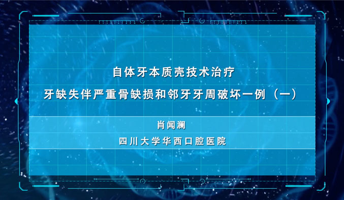 自体牙本质壳技术治疗牙缺失伴严重骨缺损和邻牙牙周破坏一例（一）