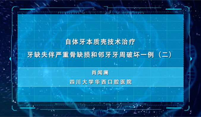 自体牙本质壳技术治疗牙缺失伴严重骨缺损和邻牙牙周破坏一例（二）