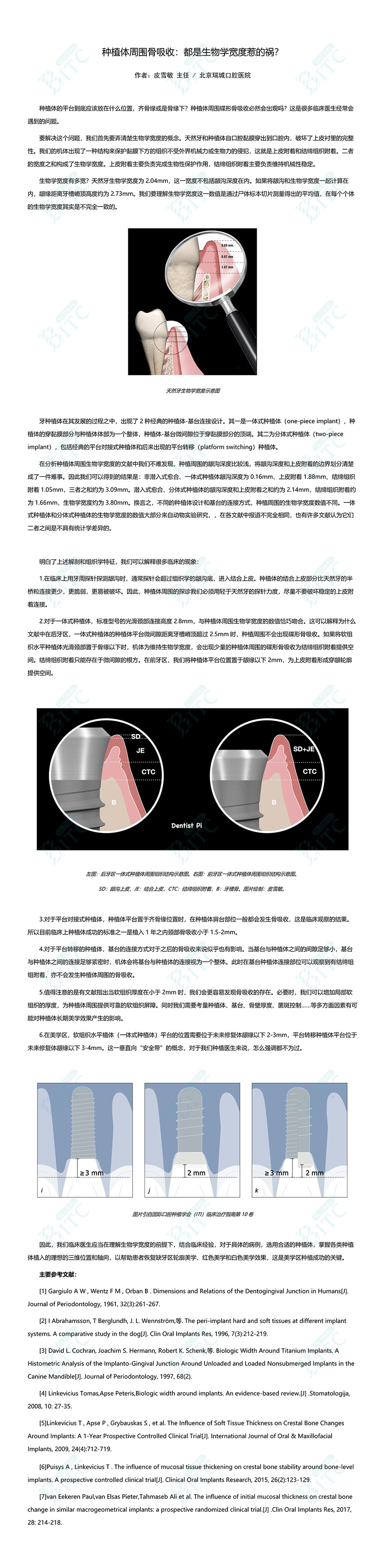 种植体周围骨吸收:都是生物学宽度惹的祸?