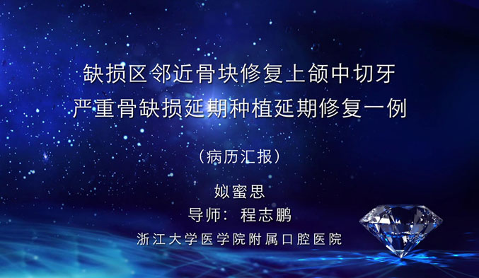 缺损区邻近骨块修复上颌中切牙严重骨缺损延期种植延期修复一例（上）