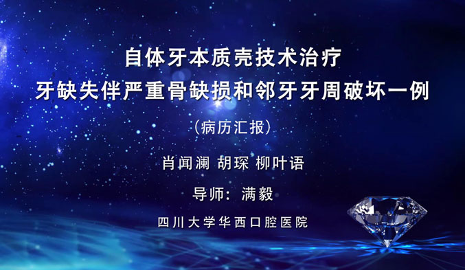 自体牙本质壳技术治疗牙缺失伴严重骨缺损和邻牙牙周破坏一例（上）