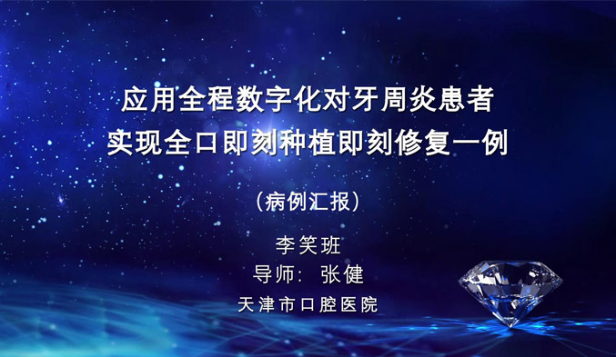 应用全程数字化对牙周炎患者实现全口即刻种植即刻修复一例（上）