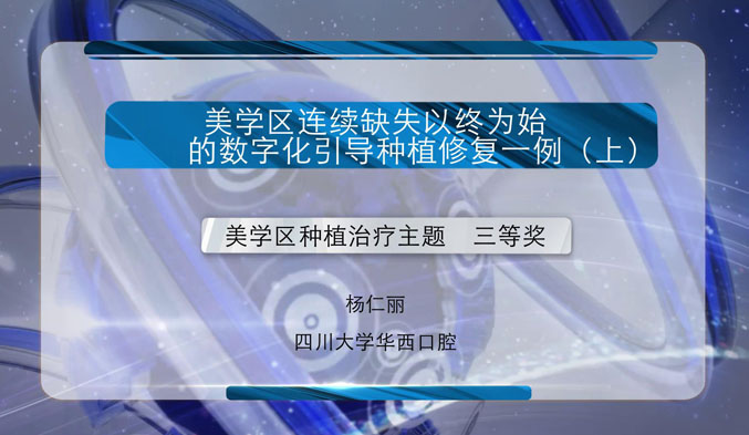 美学区连续缺失以终为始的数字化引导种植修复一例（上）