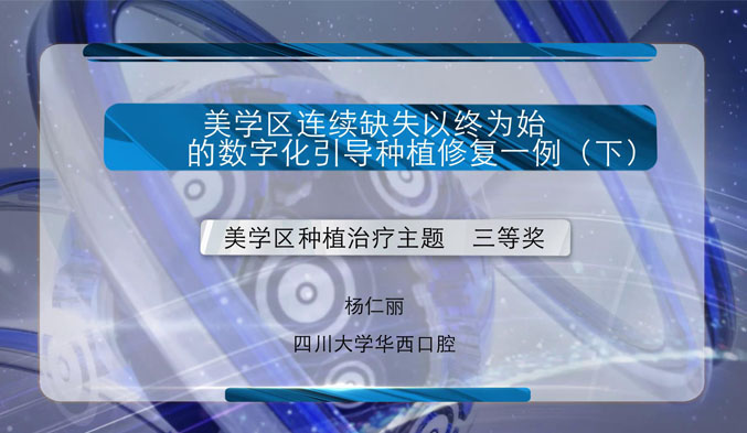 美学区连续缺失以终为始的数字化引导种植修复一例（下）