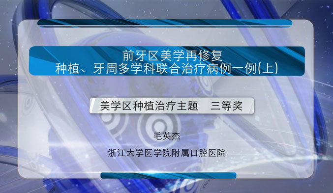 前牙区美学再修复、种植、牙周多学科联合治疗病例一例（上）