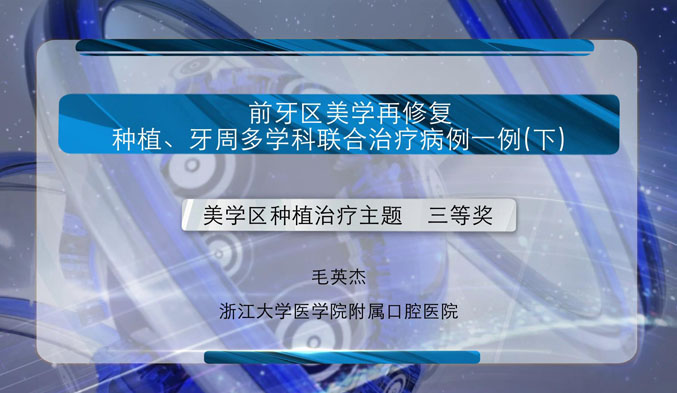 前牙区美学再修复、种植、牙周多学科联合治疗病例一例（下）