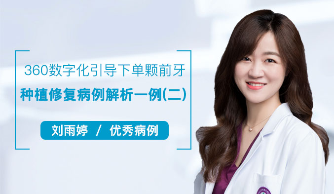 360数字化引导下单颗前牙种植修复病例解析一例（二）