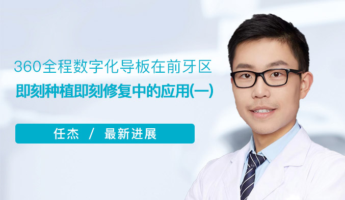 360全程数字化导板在前牙区即刻种植即刻修复中的应用（一）