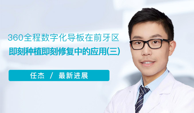 360全程数字化导板在前牙区即刻种植即刻修复中的应用（三）