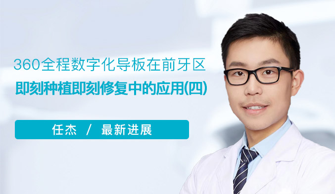 360全程数字化导板在前牙区即刻种植即刻修复中的应用（四）