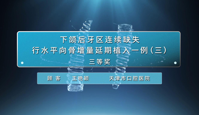 下颌后牙区连续缺失行水平向骨增量延期植入一例（三）