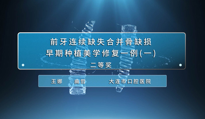 前牙连续缺失合并骨缺损早期种植美学修复一例（一）