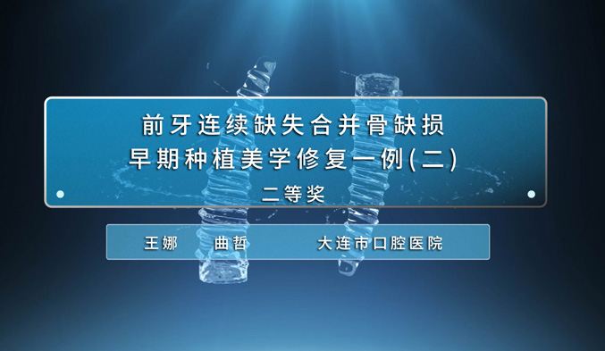 前牙连续缺失合并骨缺损早期种植美学修复一例（二）