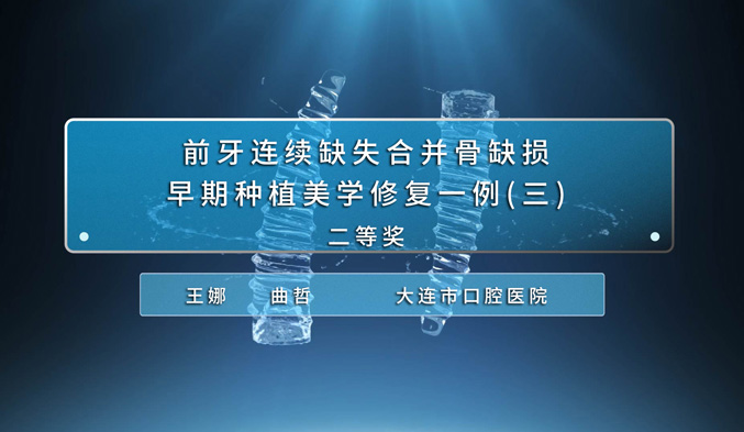 前牙连续缺失合并骨缺损早期种植美学修复一例（三）