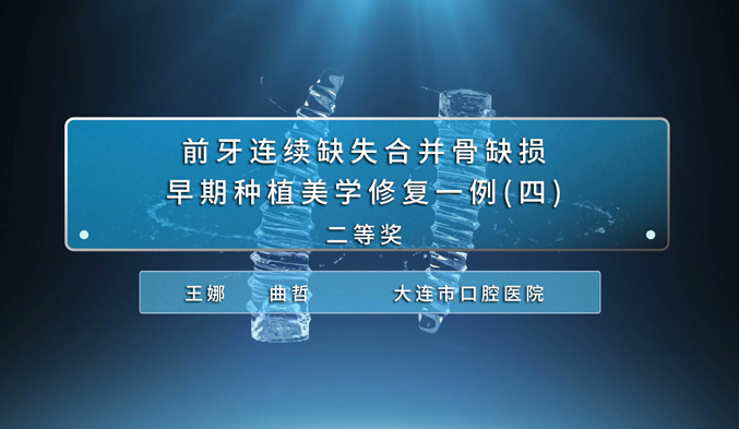 前牙连续缺失合并骨缺损早期种植美学修复一例（四）