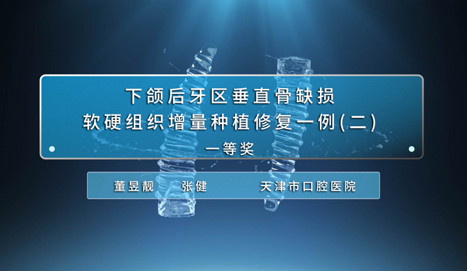 下颌后牙区垂直骨缺损软硬组织增量种植修复一例（二）