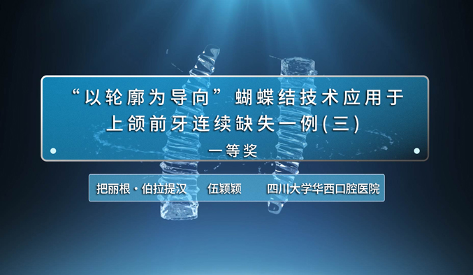 “以轮廓为导向”蝴蝶结技术应用于上颌前牙连续缺失一例（三）