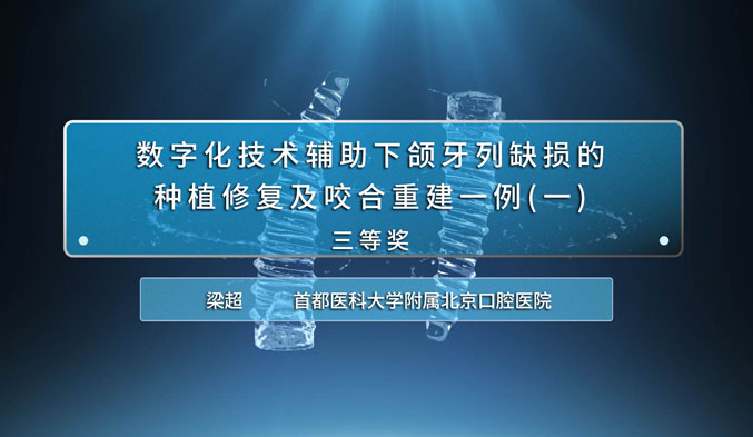 数字化技术辅助下颌牙列缺损的种植修复及咬合重建一例（一）