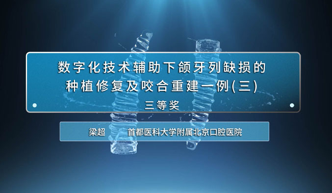 数字化技术辅助下颌牙列缺损的种植修复及咬合重建一例（三）