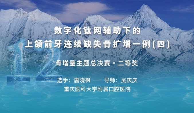 数字化钛网辅助下的上颌前牙连续缺失骨扩增一例（四）