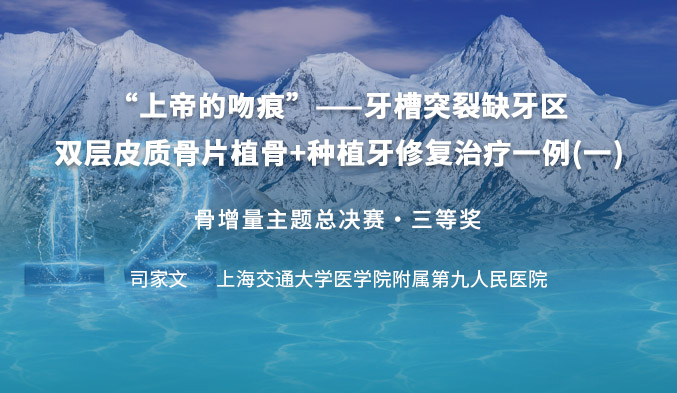 “上帝的吻痕”——牙槽突裂缺牙区双层皮质骨片植骨+种植牙修复治疗一例（一）