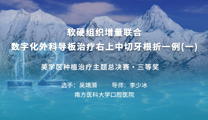 软硬组织增量联合数字化外科导板治疗右上中切牙根折一例（一）