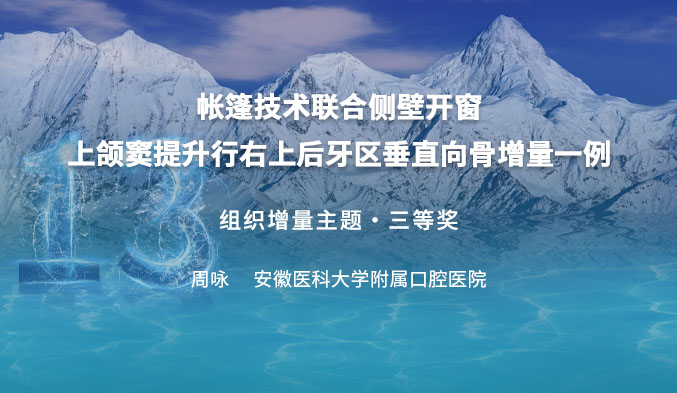 帐篷技术联合侧壁开窗上颌窦提升行右上后牙区垂直向骨增量一例