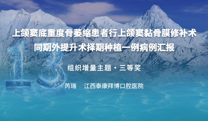 上颌窦底重度骨萎缩患者行上颌窦黏骨膜修补术同期外提升术择期种植一例病例汇报