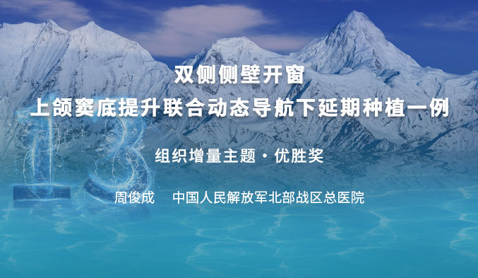 双侧侧壁开窗上颌窦底提升联合动态导航下延期种植一例