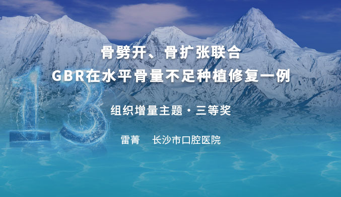 骨劈开、骨扩张联合GBR在水平骨量不足种植修复一例