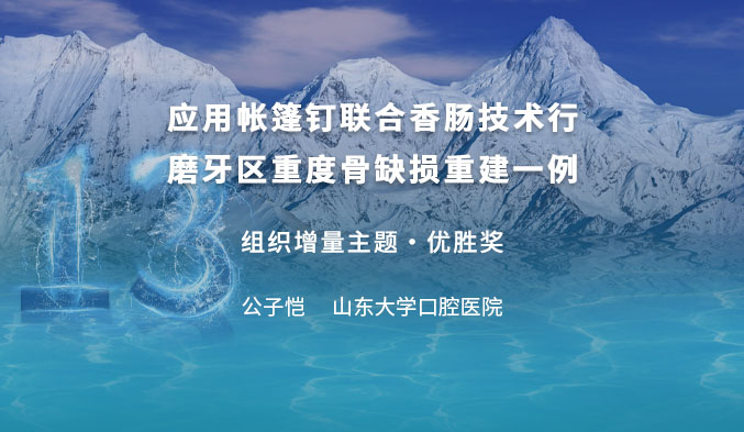 应用帐篷钉联合香肠技术行磨牙区重度骨缺损重建一例