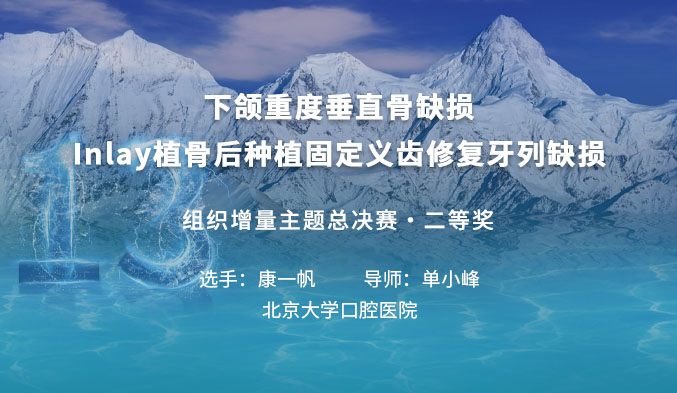 下颌重度垂直骨缺损Inlay植骨后种植固定义齿修复牙列缺损