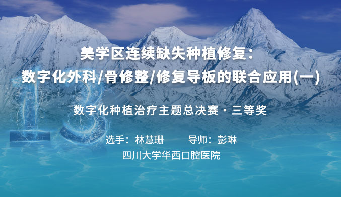 美学区连续缺失种植修复：数字化外科/骨修整/修复导板的联合应用（一）