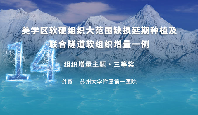 美学区软硬组织大范围缺损延期种植联合隧道软组织增量一例