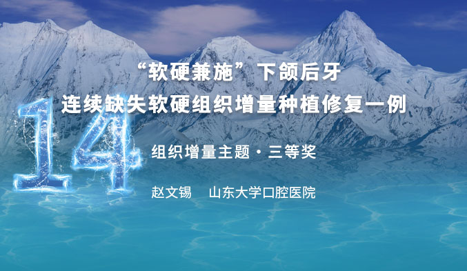 “软硬兼施”下颌后牙连续缺失软硬组织增量种植修复一例