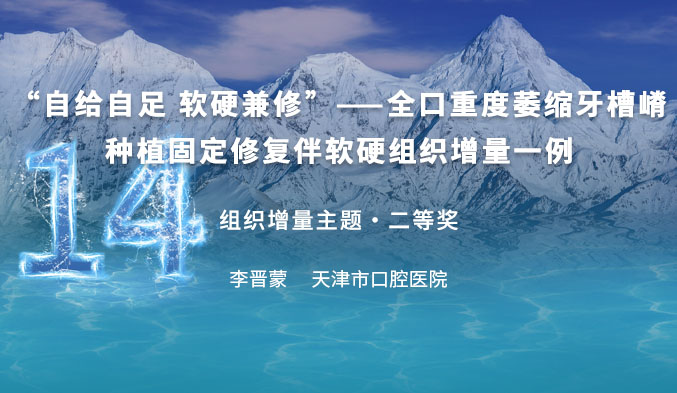 “自给自足 软硬兼修”——全口重度萎缩牙槽嵴种植固定修复伴软硬组织增量一例