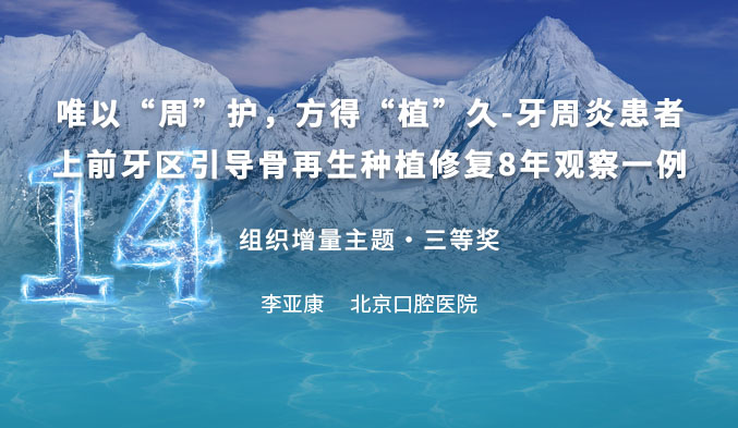 唯以“周”护，方得“植”久-牙周炎患者上前牙区引导骨再生种植修复8年观察一例