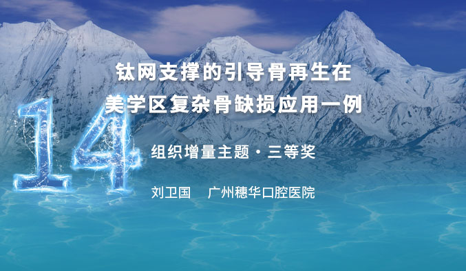 钛网支撑的引导骨再生在美学区复杂骨缺损应用一例