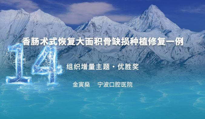 香肠术式恢复大面积骨缺损种植修复一例