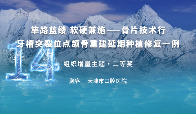 筚路蓝缕 软硬兼施——骨片技术行牙槽突裂位点颌骨重建延期种植修复一例