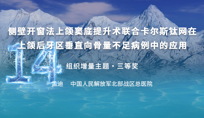 侧壁开窗法上颌窦底提升术联合卡尔斯钛网在上颌后牙区垂直向骨量不足病例中的应用
