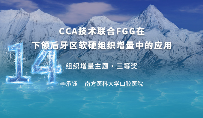 CCA技术联合FGG在下颌后牙区软硬组织增量中的应用