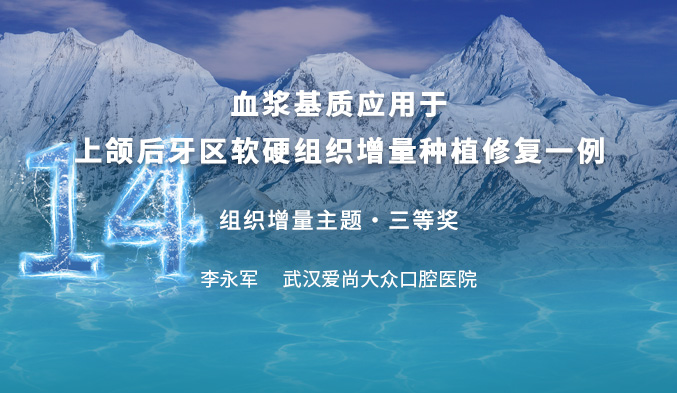 血浆基质应用于上颌后牙区软硬组织增量种植修复一例