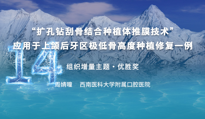 “扩孔钻刮骨结合种植体推膜技术”应用于上颌后牙区极低骨高度种植修复一例