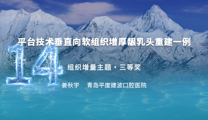 平台技术垂直向软组织增厚龈乳头重建一例