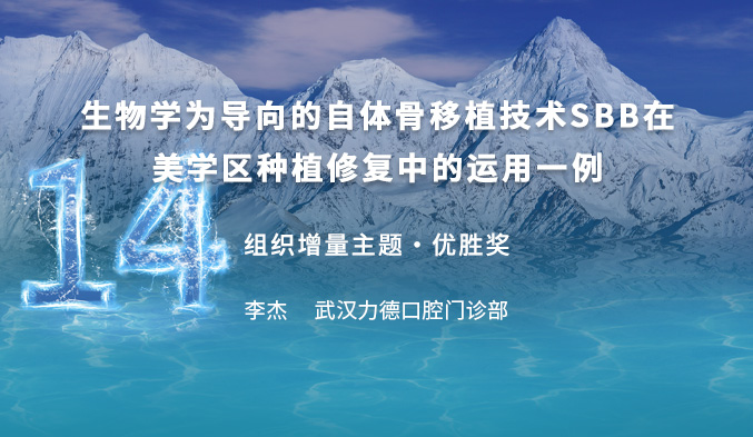 生物学为导向的自体骨移植技术SBB在美学区种植修复中的运用一例