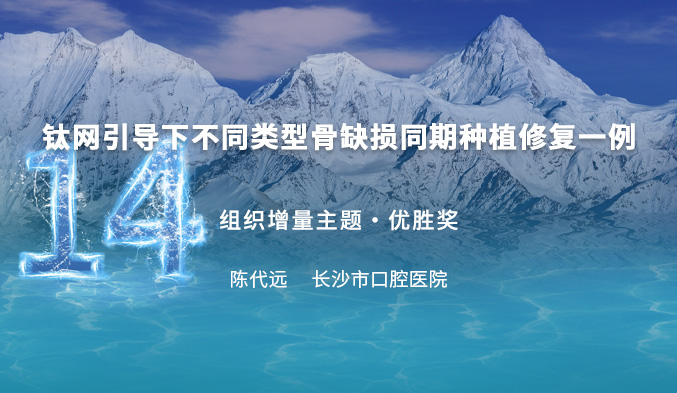 钛网引导下不同类型骨缺损同期种植修复一例