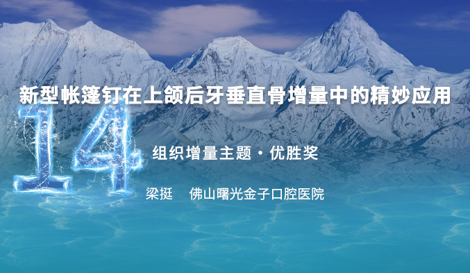 新型帐篷钉在上颌后牙垂直骨增量中的精妙应用