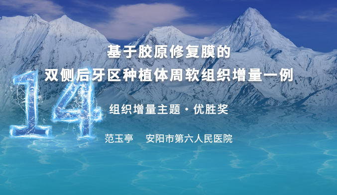 基于胶原修复膜的双侧后牙区种植体周软组织增量一例