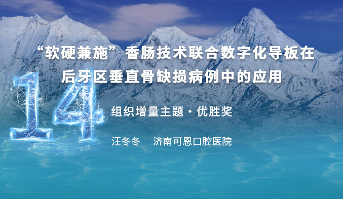 “软硬兼施”香肠技术联合数字化导板在后牙区垂直骨缺损病例中的应用